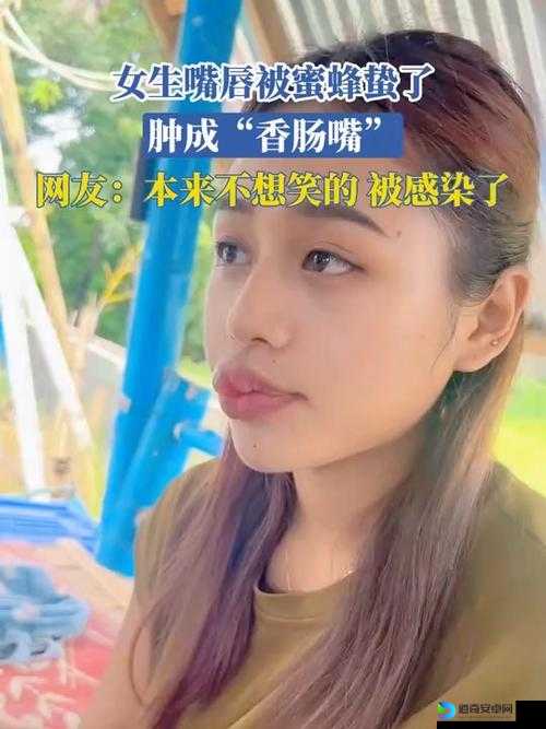 被马蜂叮嘴唇后…这是我拍的「惨叫jpg」笑到肚子痛！